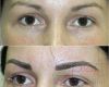 Einverständniserklärung Vorlage Permanent Make Up Genial Permanent Make Up Vorher Nachher Bilder Augenbrauen