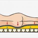 Lagerungsplan Dekubitus Vorlage Erstaunlich Dekubitus Lagerung Und Lagerungshilfsmittel