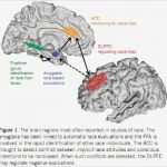 Bode Diagramm Vorlage Angenehm Amygdala Archives Neuroskeptic Neuroskeptic